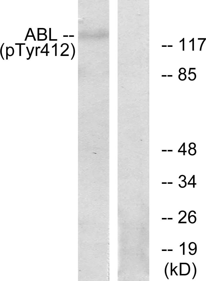 ABL Antibody (phospho-Tyr393)