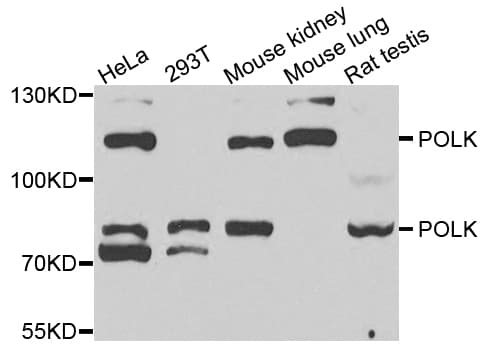 IHC-plus™ Polyclonal Rabbit anti-Human POLK / DNA Polymerase Kappa Antibody (IHC, IF, WB)