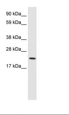 MYCL / L-Myc Antibody (aa135-184)