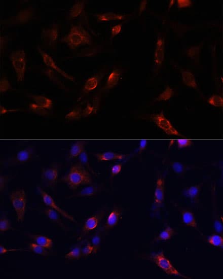 FAK / Focal Adhesion Kinase Antibody