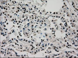 Monoclonal Mouse anti-Human GCK / Glucokinase Antibody (clone OTI3E3, IHC, IF, WB)