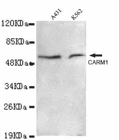 PRMT4 / CARM1 Antibody (C-Terminus)