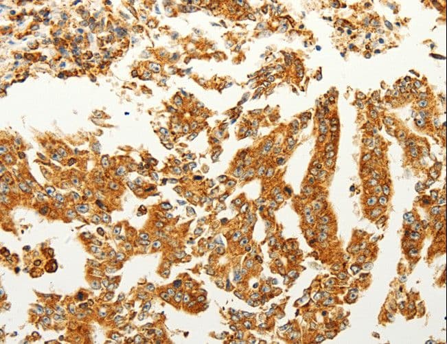 FZD6 / Frizzled 6 Antibody