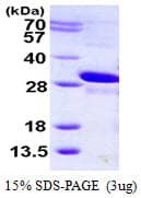 Human MRAS Protein (Recombinant His)