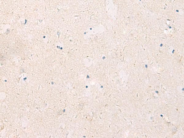Polyclonal Rabbit anti-Human KCNIP3 / Dream / Calsenilin Antibody (IHC)