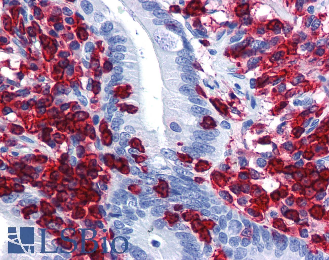 PathPlus™ Monoclonal Mouse anti-Human CORO1A / Coronin 1a Antibody (clone 4G10, IHC, WB)