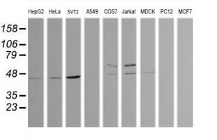TRIM38 Antibody (clone OTI14B4)