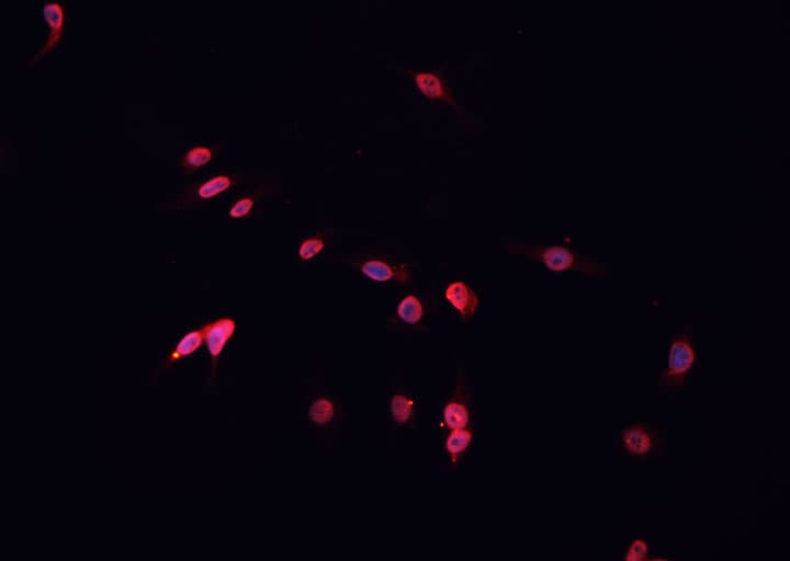 TFDP1 Antibody