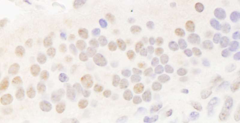 Polyclonal Rabbit anti-Human BHLHB2 / DEC1 Antibody (aa350-C-term, IHC, WB)