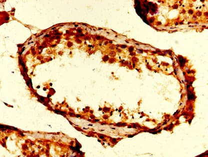 UBA52 Antibody