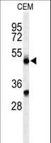 Properdin / CFP Antibody (aa197-223)