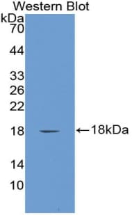 Polyclonal Rabbit anti-Human Alpha-Fetoprotein Antibody (Biotin, aa31-171, WB)