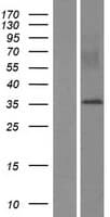 MYEOV Protein (Over-Expression Lysate Myc-DDK (Flag))