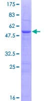 Human SC5D / ERG3 Protein (Recombinant GST)