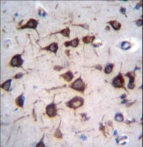 Polyclonal Rabbit anti-Human EEF1A2 Antibody (aa366-395, IHC, WB)