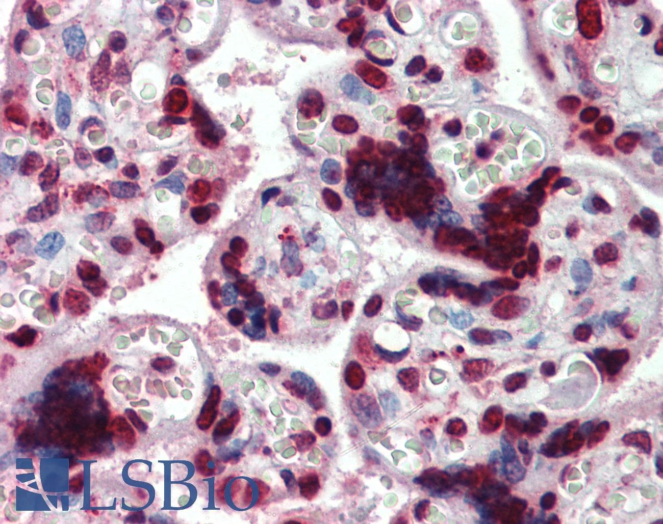 IHC-plus™ HMGIY / HMGA1 Antibody (aa9-21)