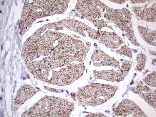 Monoclonal Mouse anti-Human MCAM / CD146 Antibody (clone UMAB155, Carrier-free, IHC, WB)