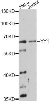 Polyclonal Rabbit anti-Human YY1 Antibody (WB)