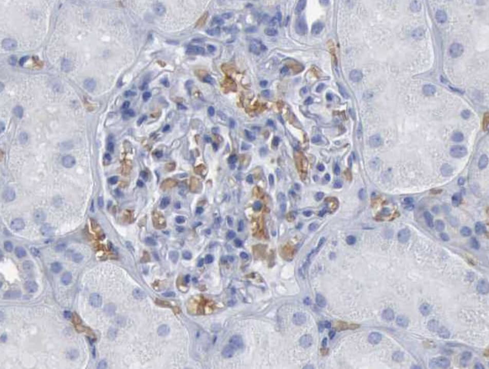 TGFB1 / TGF Beta 1 Antibody