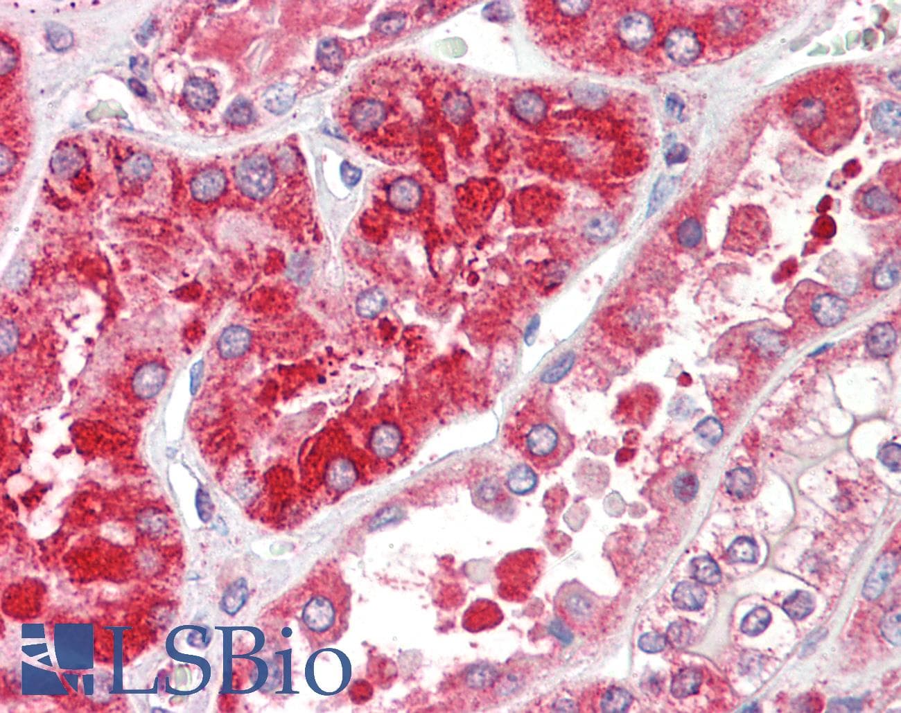 IHC-plus™ Ferritin Antibody