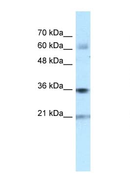 PIM1 / Pim-1 Antibody (N-Terminus)