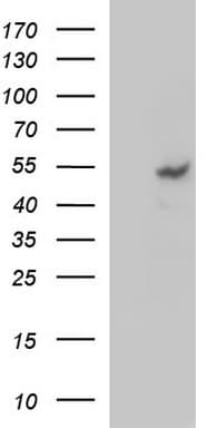 MMP13 Antibody (aa104-471, clone OTI4B7, Carrier-free)