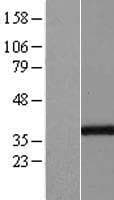 GGPS1 Protein (Over-Expression Lysate Myc-DDK (Flag))