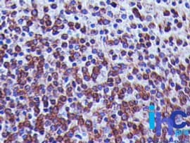 TREX1 Antibody (aa211-350, clone 41M5F2)