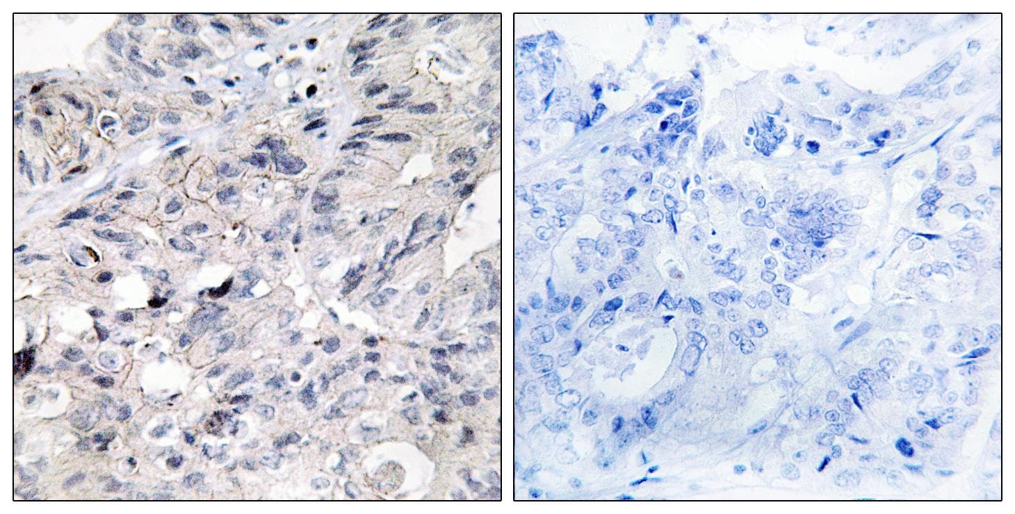 TNF Alpha Antibody