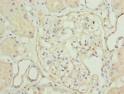 Polyclonal Rabbit anti-Human TPPP2 Antibody (IHC, WB)