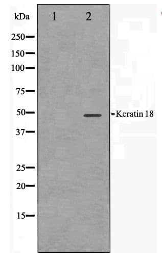 KRT18 / CK18 / Cytokeratin 18 Antibody