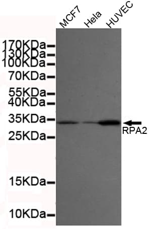 RPA2 / RFA2 / RPA34 Antibody