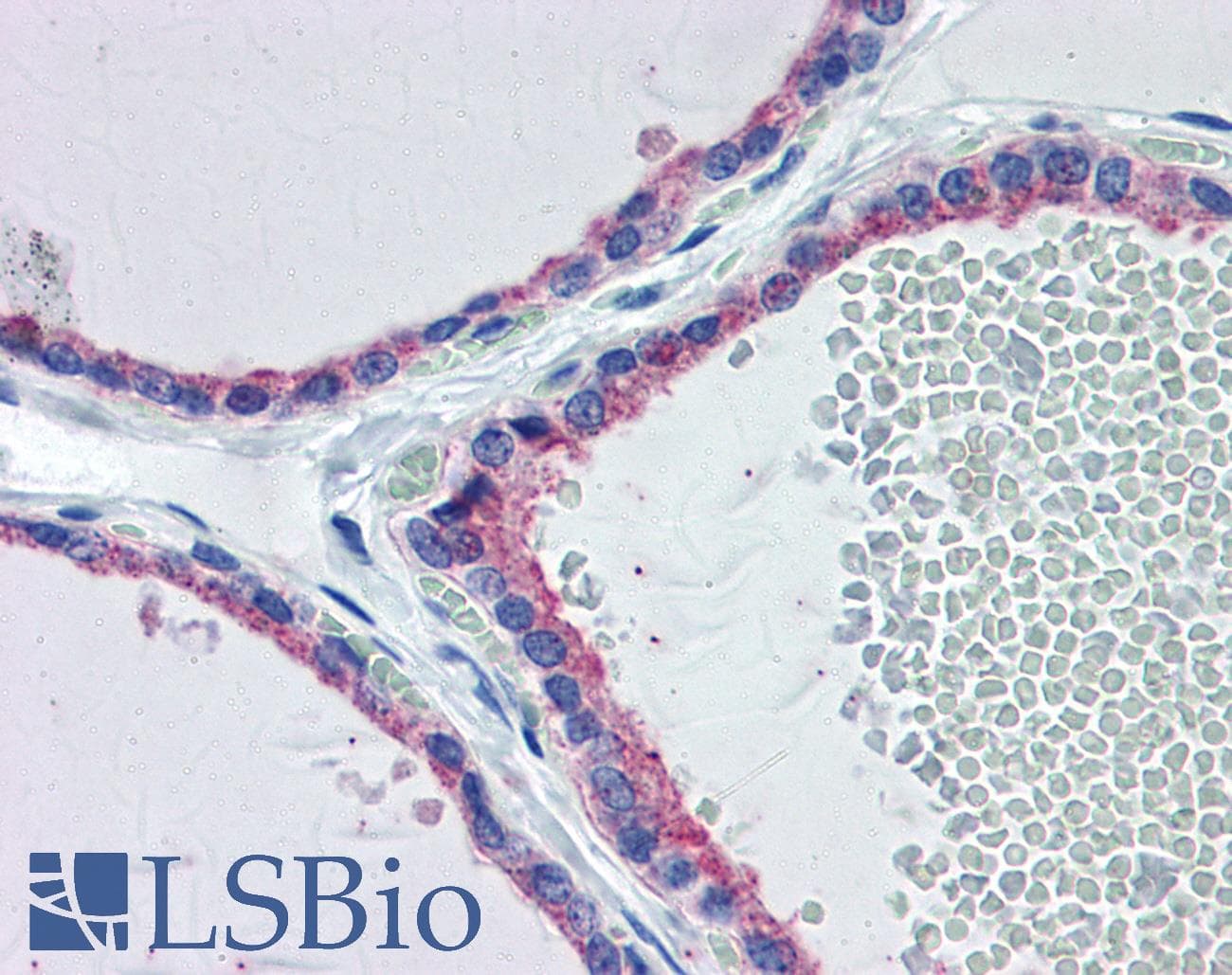 IHC-plus™ Polyclonal Rabbit anti-Human FGFR2 / FGF Receptor 2 Antibody (aa471-520, IHC, WB)