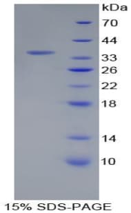 Rat Prothrombin Fragment 1+2 Protein (Recombinant His-T7)
