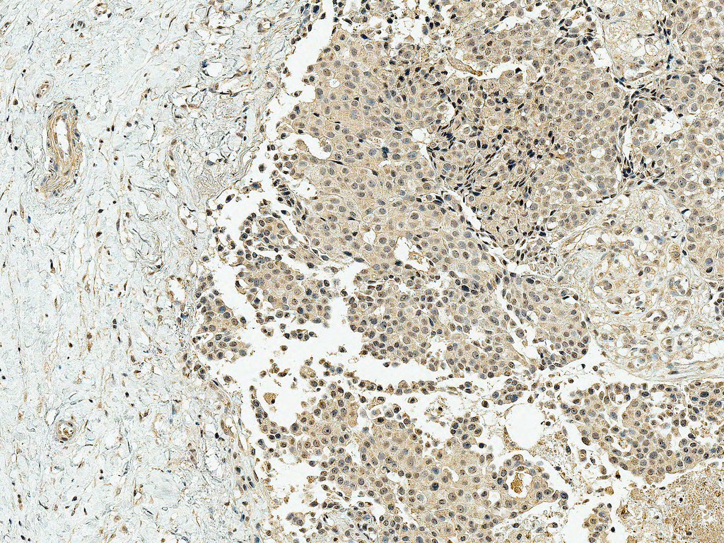 CREBBP / CREB Binding Protein Antibody