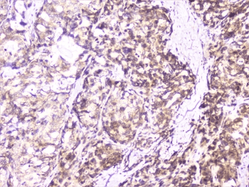 UBE2I / UBC9 Antibody
