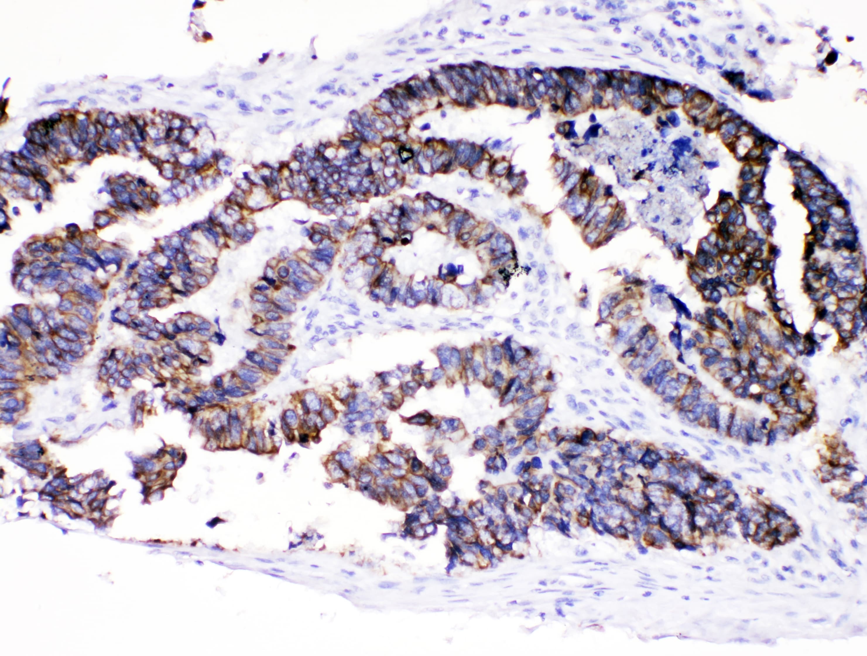 KRT8 / CK8 / Cytokeratin 8 Antibody