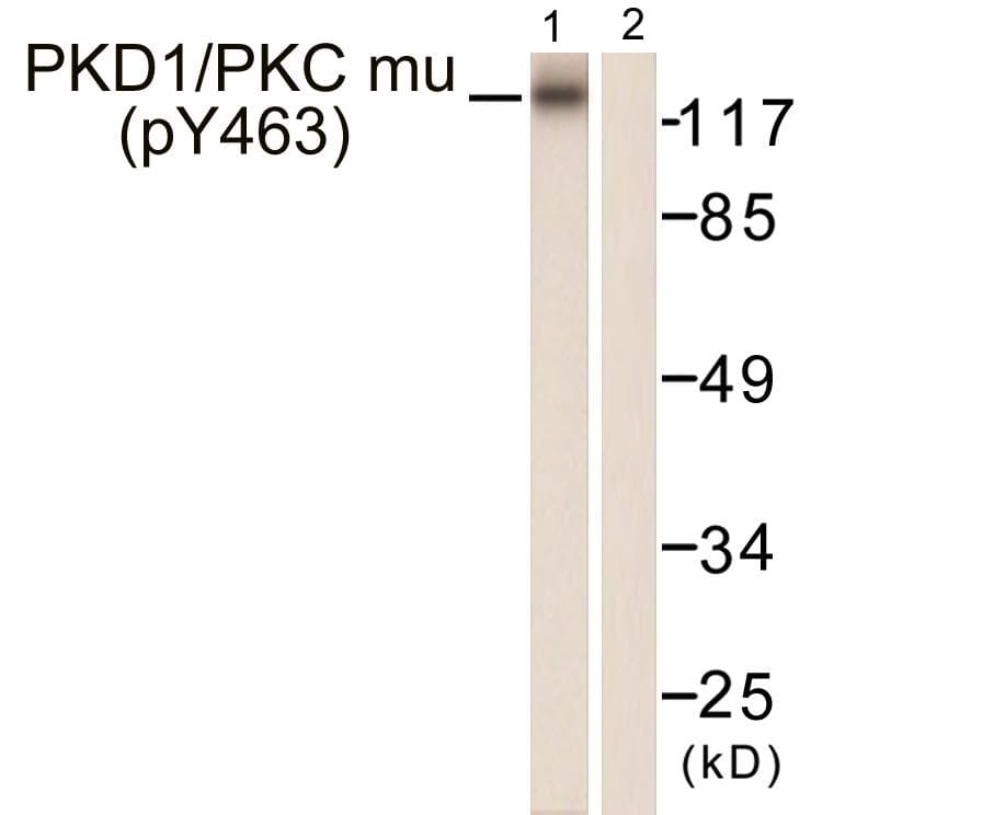 PRKD1 / PKC Mu Antibody (phospho-Tyr463)