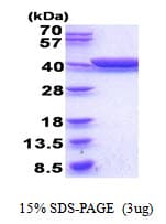 E. coli gldA Protein (Recombinant His)