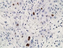 TP53 / p53 Antibody (clone OTI2C4)