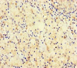 SPATA16 / NYD-SP12 Antibody