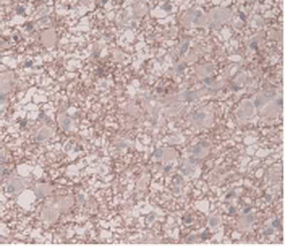 SERPINE1 / PAI-1 Antibody (Biotin)