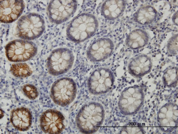 EPHB3 / EPH Receptor B3 Antibody (clone 1B3)
