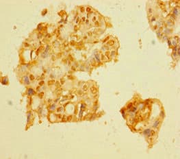 VPRBP Antibody