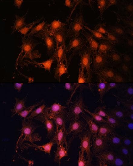 E2F1 Antibody