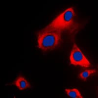 GK / Glycerol Kinase Antibody (C-Terminus)
