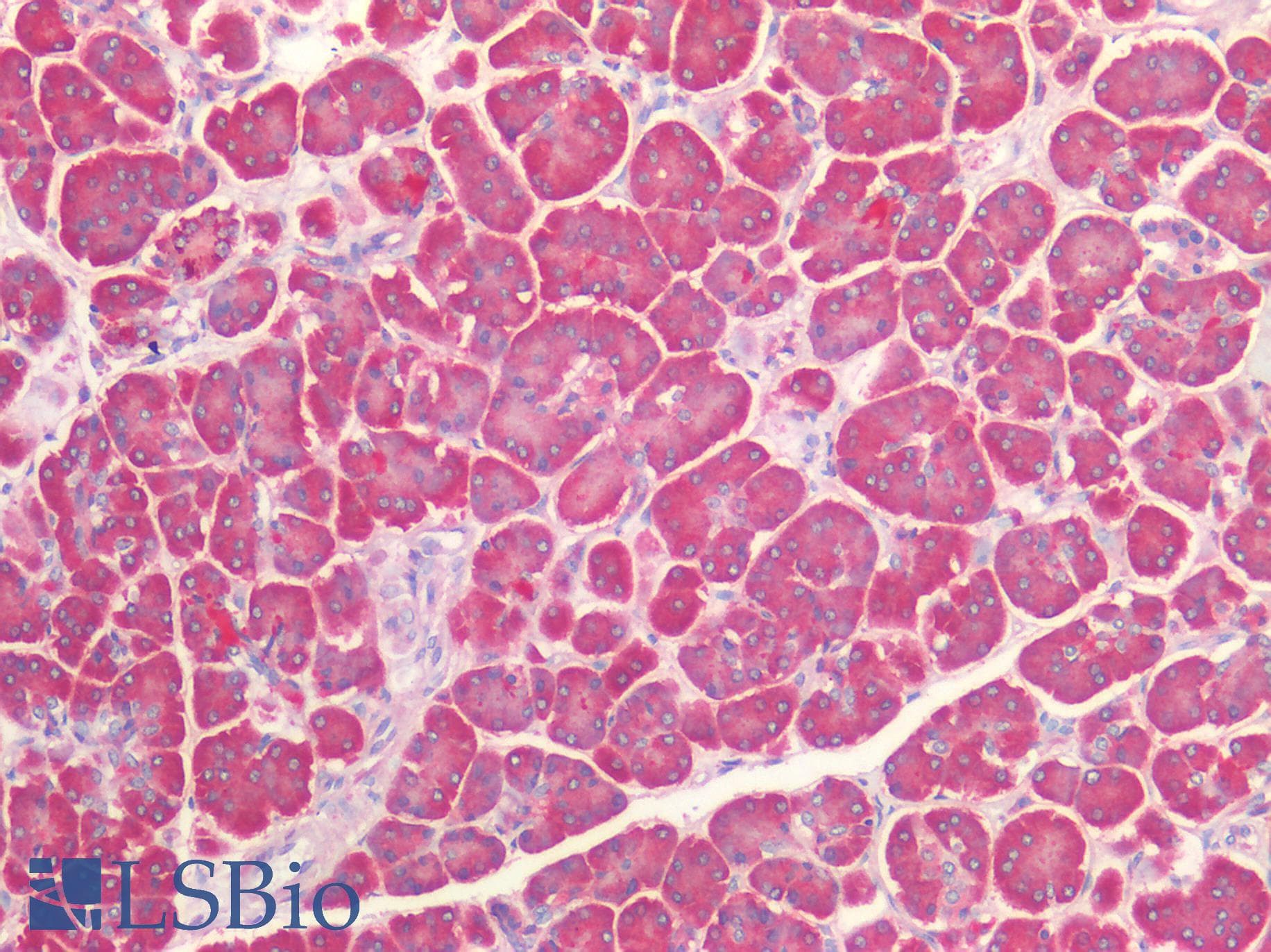 IHC-plus™ Polyclonal Rabbit anti-Human TNC / Tenascin C Antibody (IHC)