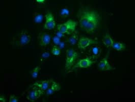 HP / Haptoglobin Antibody (clone OTI2B8)