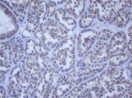 Monoclonal Mouse anti-Human DDX59 Antibody (clone OTI2G1, IHC, WB)