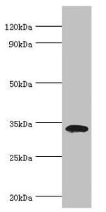 Polyclonal Rabbit anti-Human ARH / LDLRAP1 Antibody (aa59-308, IHC, WB)